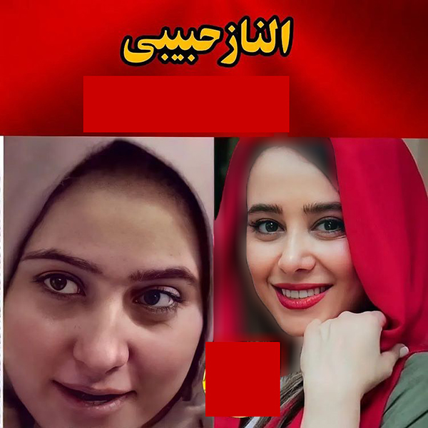 عکس قبل عمل بینی بازیگران