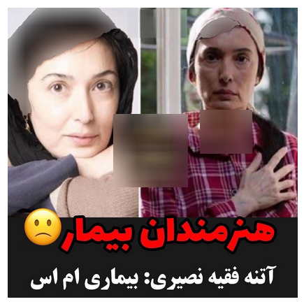 هنرمندانی که بیماری سختی دارند 
