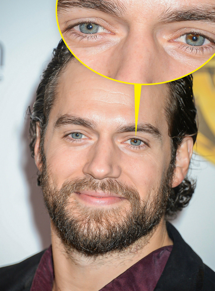 عکس‌های لو رفته از چند آدم مشهور که نشان می‌دهد زیبا نیستند