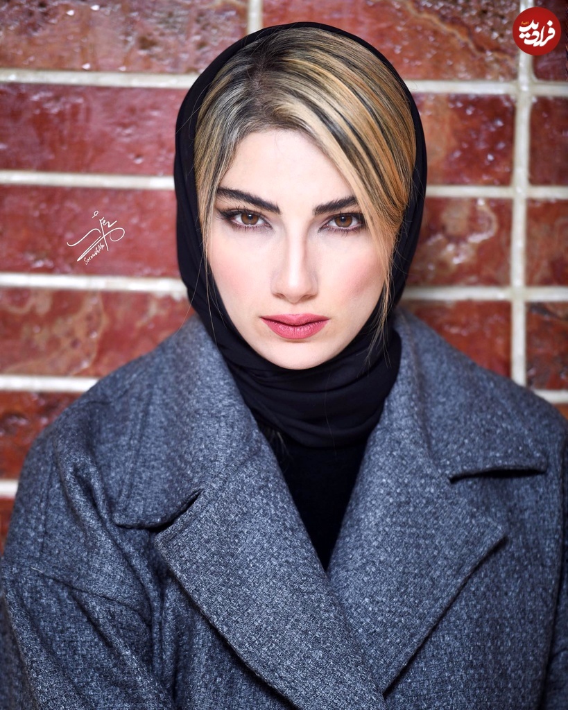  تغییر چهره خواهرزاده اوس موسی در پایتخت بعد 9 سال