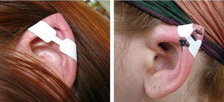 تبانی بلاگرهای ایسنتاگرامی و جراحان زیبایی