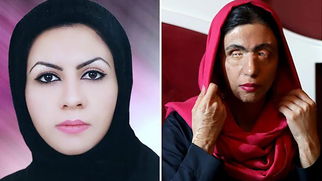 معصومه عطایی