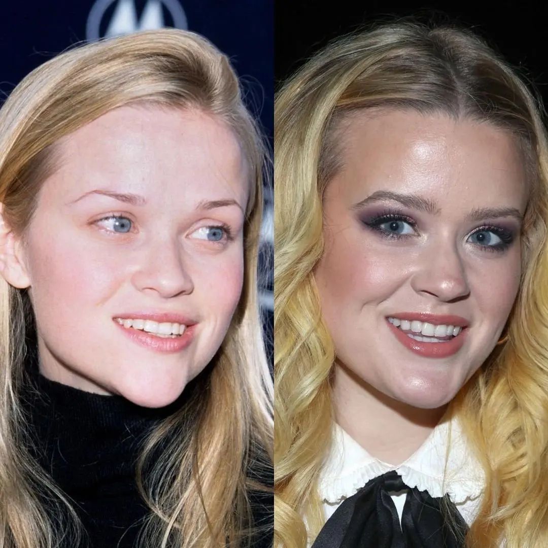 شباهت مادران و دختران