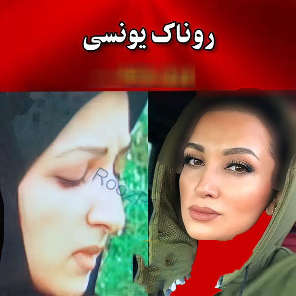 عکس قبل عمل بینی بازیگران