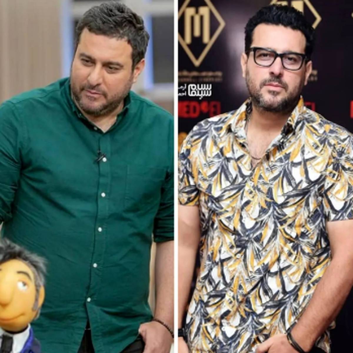 چهره شکسته و خسته محسن کیایی بعد از ۵۰ کیلو کاهش وزن | محسن کیایی قبل و بعد از عمل 