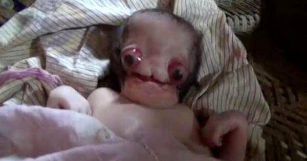 تولد نوزاد عجیبالخلقه در جهان + عکس