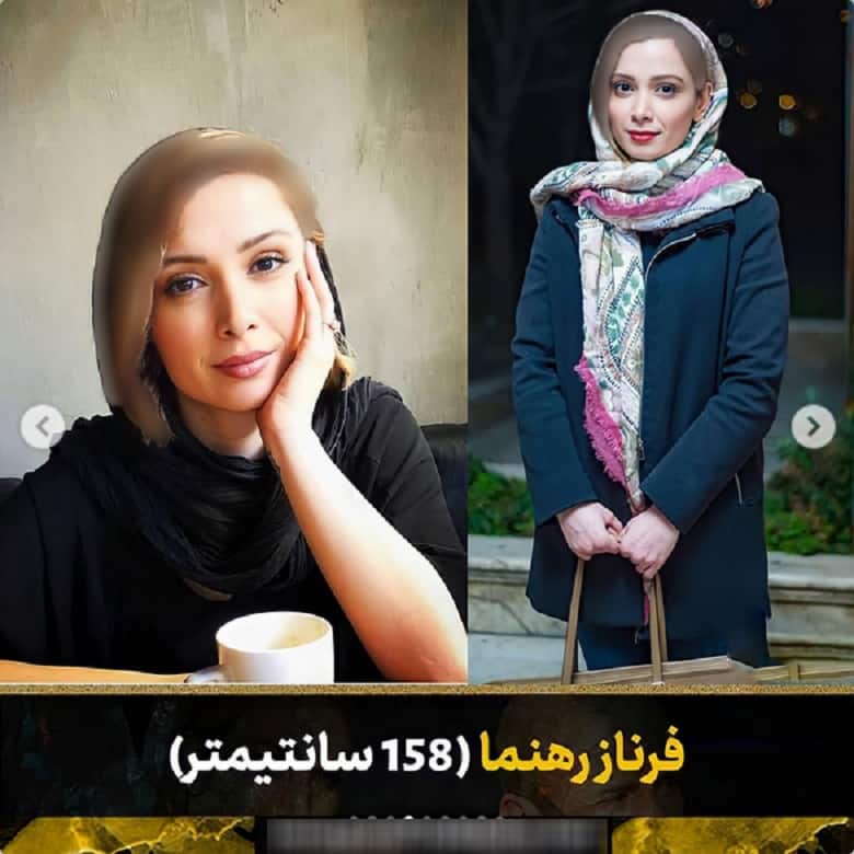 فرناز رهنما قدش کوتاه است.