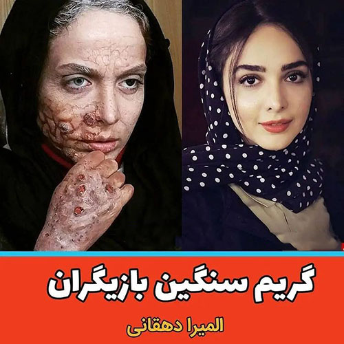 المیرا دهقانی
