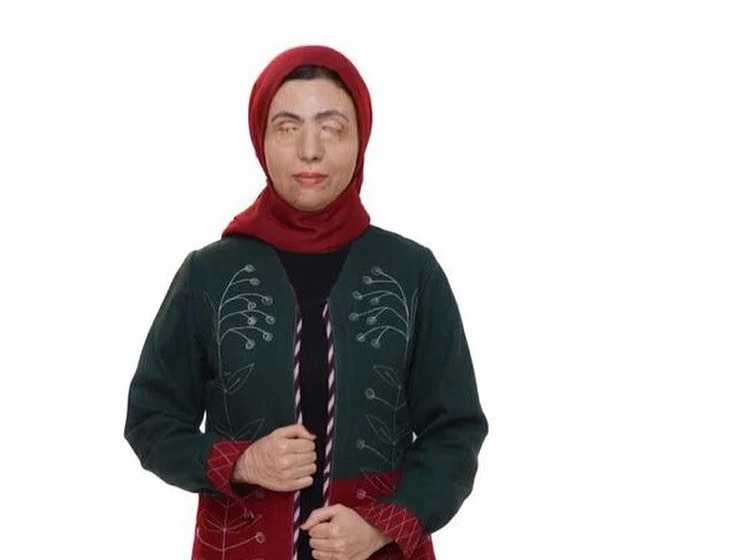 معصومه عطایی اسیدپاشی