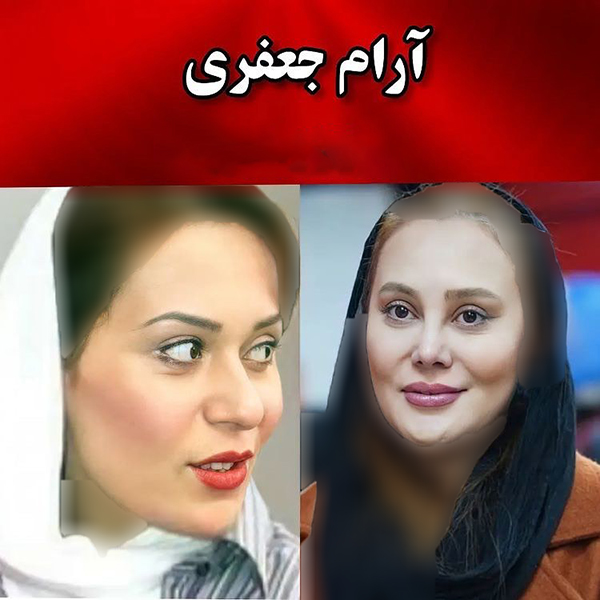 عکس قبل عمل بینی بازیگران