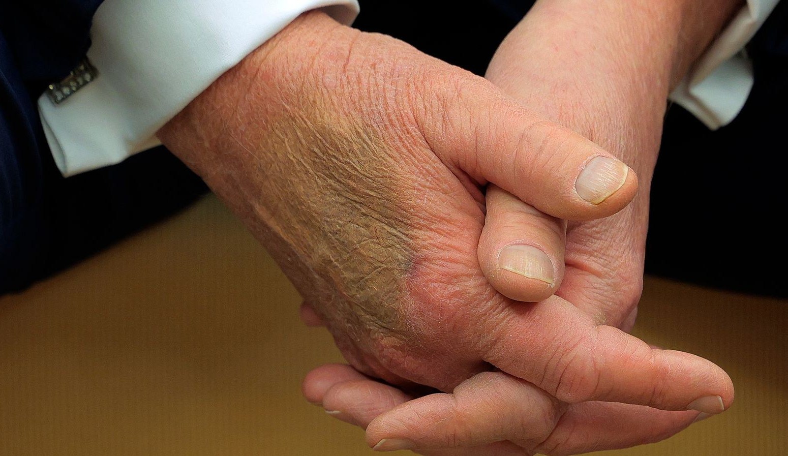 دونالد ترامپ , 