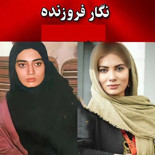 عکس قبل عمل بینی بازیگران