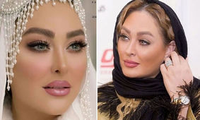 تزریق‌ها و بوتاکس‌های الهام حمیدی؛ راز زیبایی چهره او فاش شد!