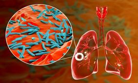 سازمان بهداشت جهانی از افزایش موارد ابتلا به یکی از کشنده‌ترین بیماری‌های دنیا خبر داد
