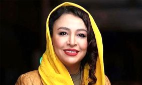 عکس متفاوت از مهلقا باقری بعد از جراحی زیبایی!