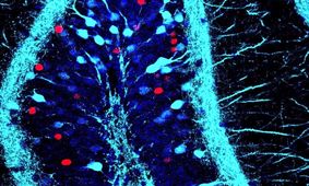 قدرت حافظه احساسی برای درمان اختلالات ذهنی
