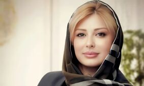 تغییر چهره نیوشا ضیغمی بعد از جدیدترین عمل زیبایی / کوبید از نو ساخت !