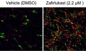 کشف متابولیت طبیعی که چربی بد را به خوب تبدیل می‌کند
