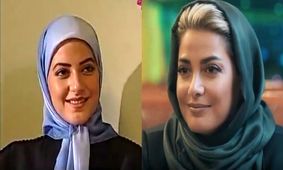 عکس قبل و بعد عمل زیبایی 7 خانم بازیگر ایرانی / چه بودند و چه شدند! + اسامی