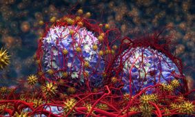 علائم تومور بدخیم چه هستند؟