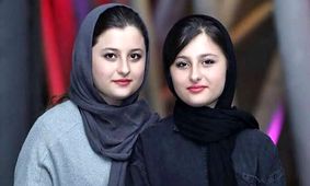 جراحی نیکای محبوب سریال پایتخت: تغییرات شگفت‌انگیز چهره‌اش!