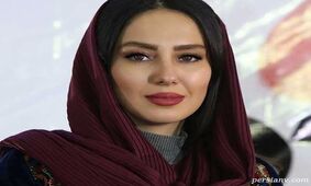 عمل های زیبایی شیدا یوسفی لو رفت / خانم بازیگر خیلی عوض شد !
