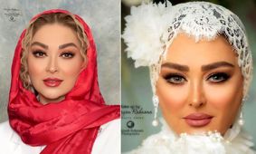 عکس باورنکردنی از صورت خونی الهام حمیدی / چهره پر از عمل و آرایش به چه روزی افتاد!