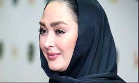 عکس/ تغییر چهره الهام حمیدی که همه را شوکه کرد!