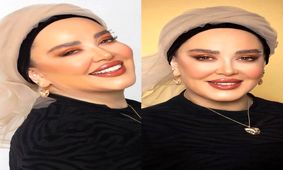 عکس جنجالی از تغییر چهره بهاره رهنما با جدیدترین عمل زیبایی