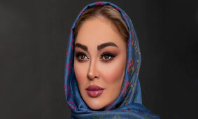 تغییر چهره خیلی متفاوت الهام حمیدی بعد از عمل زیبایی / این اون نیست ! + عکس ها