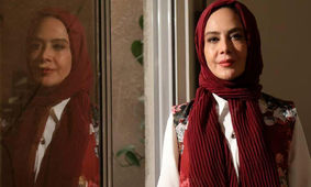 عکس قبل عمل زیبایی خانم بازیگر سرشناس ایرانی / تغییری که شوکه تان می کند !