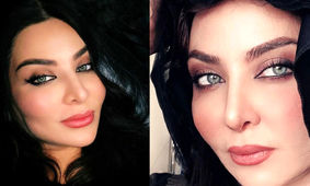 از دیدن چهره قبل از عمل فقیهه سلطانی حیرت می کنید + عکس قبل و بعد جراحی