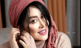 جنجال تغییر چهره سارا منجزی پور با جدیدترین عمل زیبایی / اصلا نمی شناسیدش !