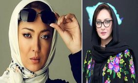 عکس های حیرت آور از قبل و بعد 9 خانم بازیگر ایرانی / روز به روز زیباتر می شوند