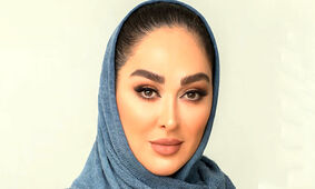 عجیب ترین تغییر چهره عروسکی الهام حمیدی / 6 عکس از خانم بازیگر بعد از عمل زیبایی !