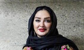 عکس های خیره کننده از الهام حمیدی بعد عمل های زیبایی
