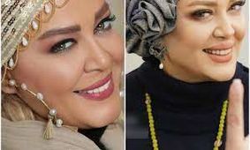 عمل زیبایی صورت این خانم بازیگران را نابود کرد / چرا به این وضع افتادند ؟!