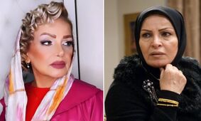 جوان تر شدن خانم بازیگر دهه 60 با عمل زیبایی / جدیدترین عکس ها از کولاک هما خاکپاش !