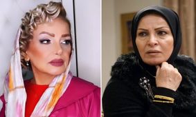 جوان تر شدن خانم بازیگر دهه 60 با عمل زیبایی / جدیدترین عکس ها از کولاک هما خاکپاش !