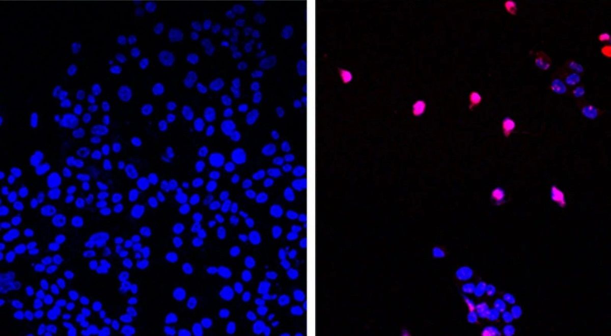 نخستین قرص عمومی سرطان معرفی شد