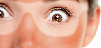 آفتاب سوختگی