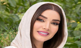 تغییر چهره متین ستوده با بوتاکس چشم گربه ای ! / زیر و رو شد ! + عکس