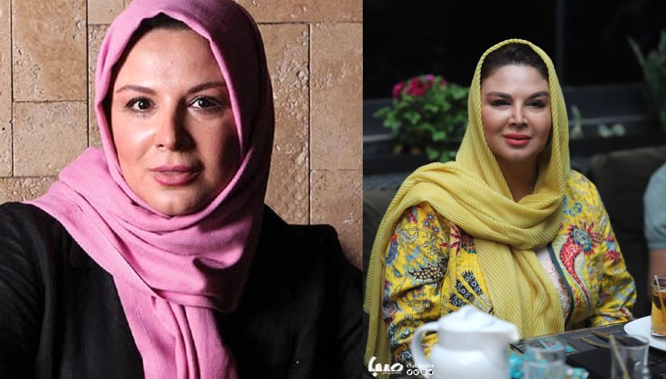 عکسی از تغییر چهره غیرقابل باور شهره سلطانی 