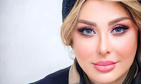 عکس خیره کننده از زیبایی چشمگیر نیوشا ضیغمی / بعد طلاق جذابتر شد !