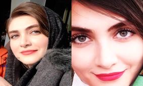 جذابیت خیره کننده الناز ملک در سریال زخم کاری / زیبایی که در سقوط پنهان شد !