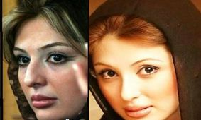 عکس قبل و بعد 7 خانم بازیگر ایرانی بعد از عمل های عروسکی / چه بودند و چه شدند !