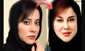 تغییر چهره خیلی زیبا آشا محرابی بعد از تزریقات زیبایی / متفاوت تر از همیشه !