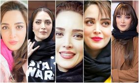  تغییر چهره فاحش بهنوش طباطبایی بعد عمل زیبایی + عکس مقایسه قدیمی و جدید خانم بازیگر