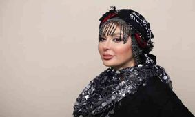 تغییر چهره شوکه کننده نیوشا ضیغمی بعد از جدیدترین عمل زیبایی ! / شوکه می شوید !