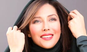 عکس لو رفته از مهتاب کرامتی قبل از عمل زیبایی